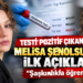 Testi Pozitif Çıkan Melisa Şenolsun’dan İlk Açıklama: “Şaşkınlıkla Öğrendim”